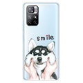 Etui z TPU IMD do Xiaomi Redmi Note 11 Pro/Note 11 Pro+ - Smile